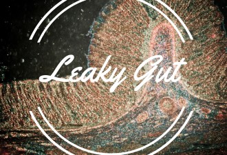 Dr Aggie Matusik - Leaky Gut